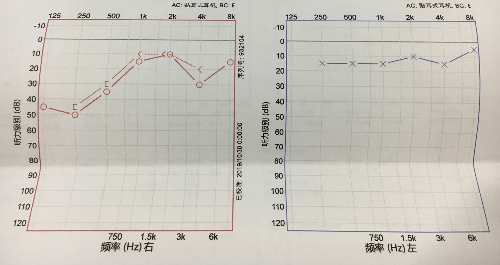 耳鸣诊断结果